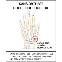 Orthèse de pouce rigide thermoformable | Pouce douloureux et déformé